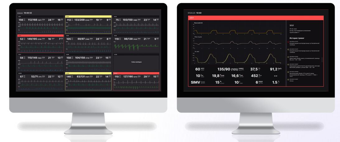 Центральная мониторная станция Ростеха для отделений интенсивной терапии успешно испытана в клиниках