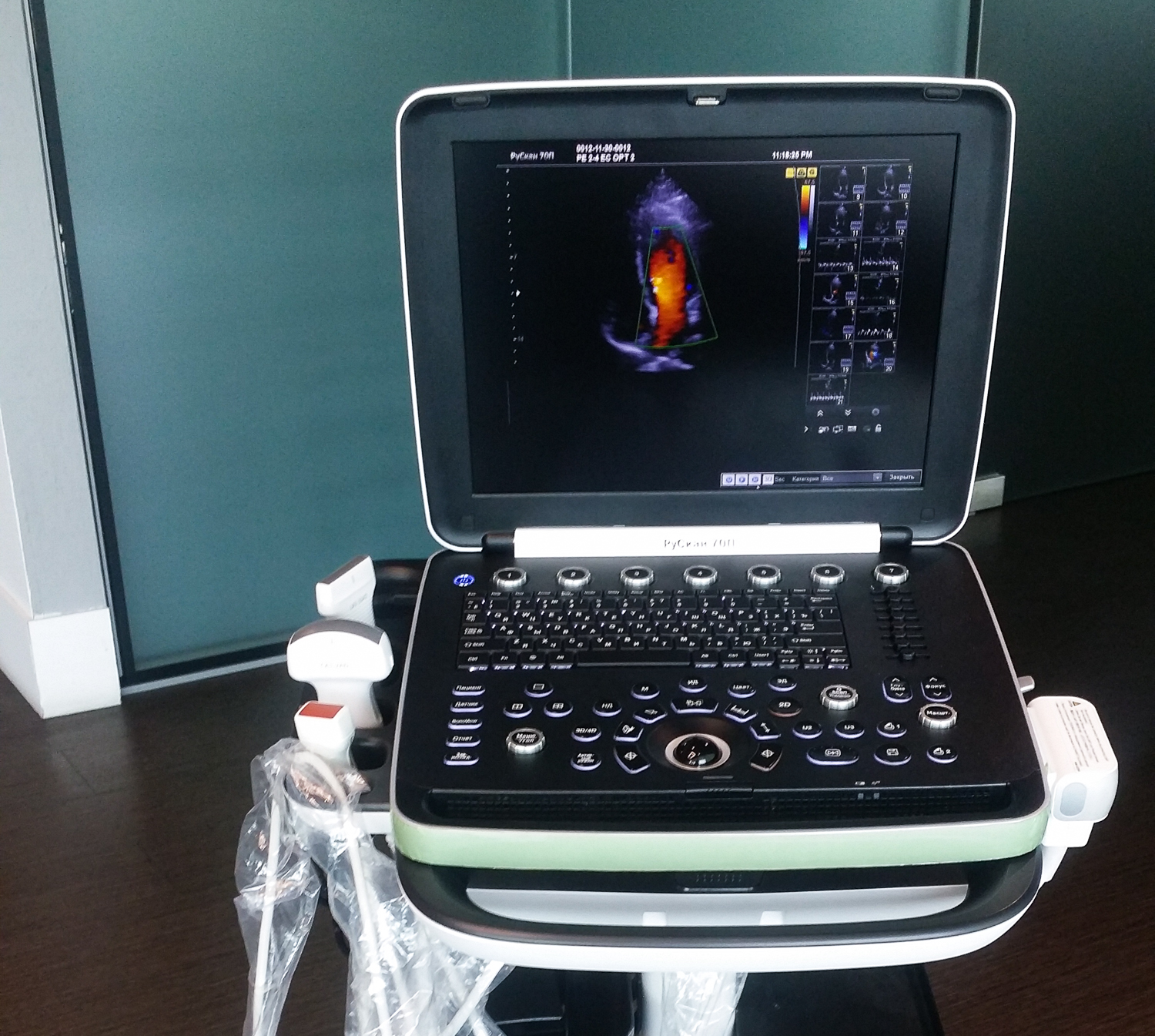 Ростех представил первый отечественный портативный УЗИ-сканер