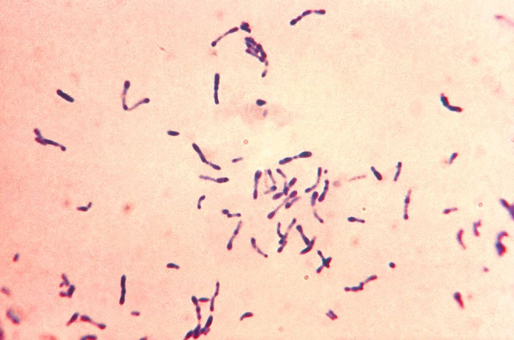 Corynebacterium_diphtheriae_Gram_stain.jpg